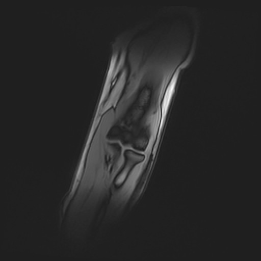 Click on the Serie image to view the images of Wieszt, Gnter